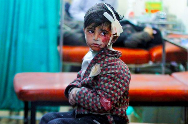 Esad’ın, Halep’te katledilen çocuklar sorusuna verdiği tüyler ürpertici cevabı