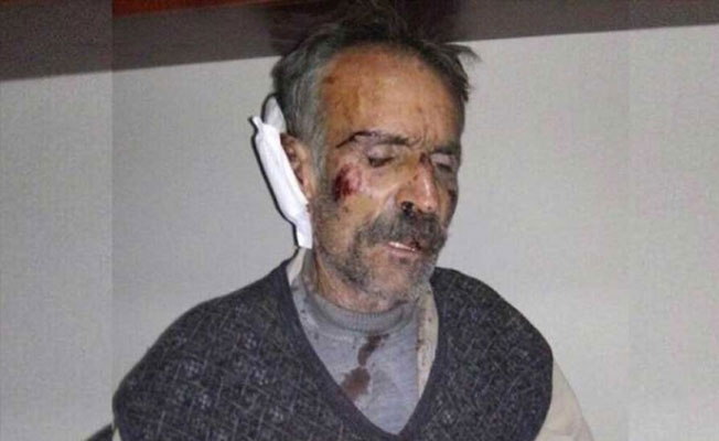 İşkence gördükten sonra tutuklanan Aykut hastaneye kaldırıldı
