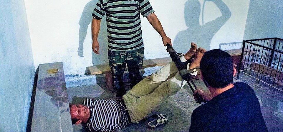 İşkence merkezi Zonguldak’ta insanlık dışı bir skandal daha: Polis elektro şok cihazı ile elektrik verdiler