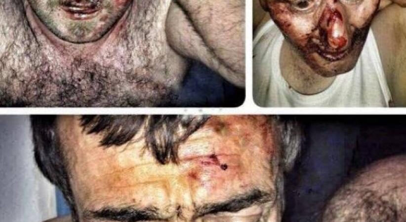 Van’da mantar toplayan vatandaşlar terörden gözaltına alındı; İşkenceye uğradı