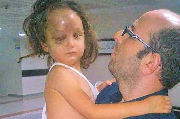 Ramazan ve Bayram dinlemeyen zulüm, acılar paylaşıldıkça azalır: Sezer ailesinin yaşadıklarını kim kaldırabilir?