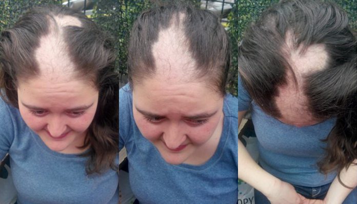 Woman whose hair ripped out by Turkish police arrested