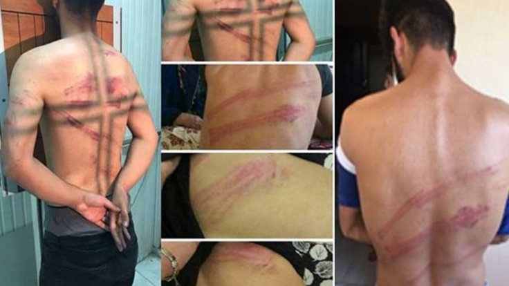 Valilik’ten ‘köylülere işkence’ açıklaması: Zor kullanılarak derdest edildiler
