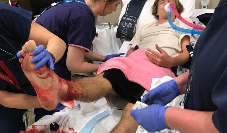 Eşine rastlanmayan canlı: Melbourne’de denize giren genç, korkunç felaketle karşı karşıya kaldı