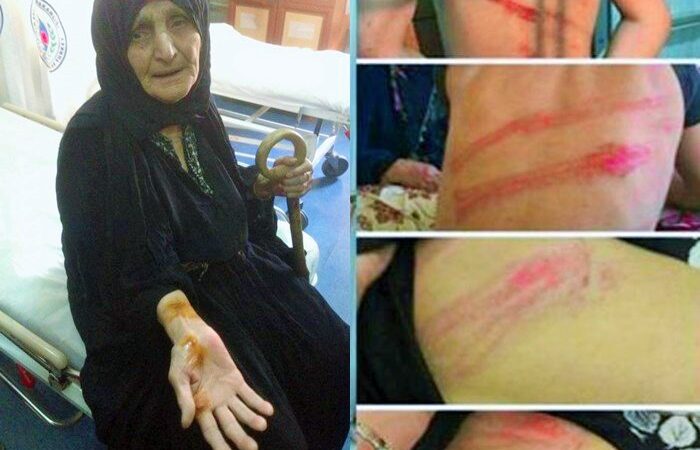 Darp edilen 89 yaşındaki Zekiye Nine: Sebepsiz ve suçsuz yere bu işkenceyi yapanları Allah kabul etmesin