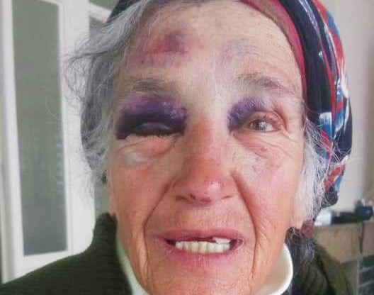 Polis, işini geri isteyen Perihan Nine’yi darp etti