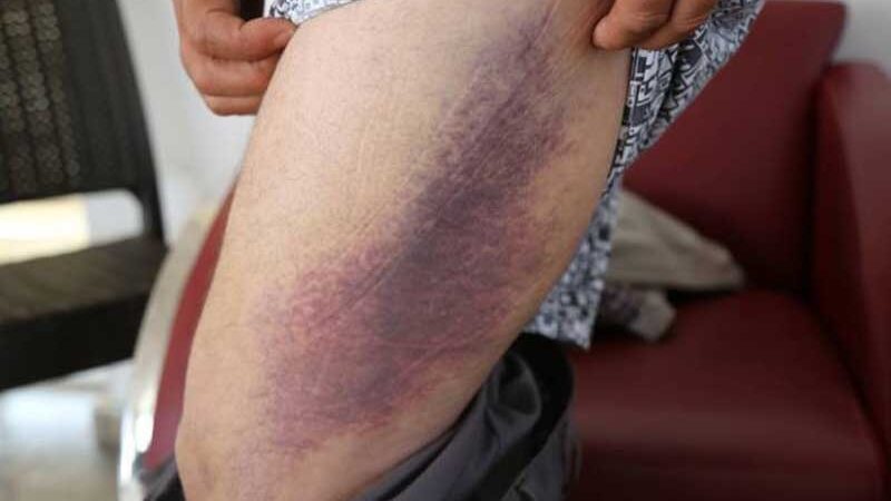 Yaylak Jandarma Karakolu’ndan Urfa TEM’e kadar süren işkenceyi anlattı
