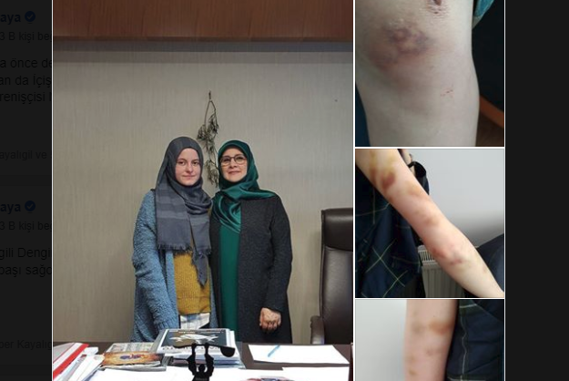 Acun Karadağ’ın evini giren polis dağıttı: Bakan Süleyman Soylu tarafından tehdit edilen, Merve Demirel’e gözaltında acımasızca işkence