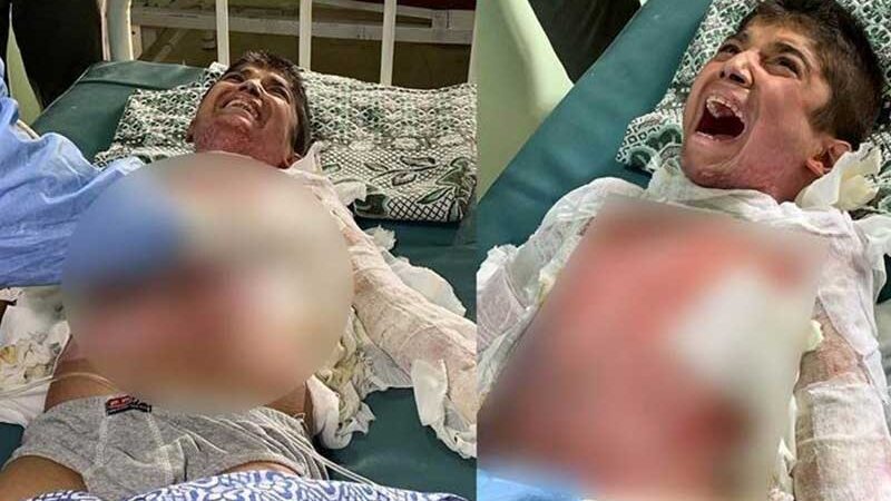 Kimyasal silahla yaralandığından şüphelenilen çocuğun tedavisi Erbil’de yapılacak