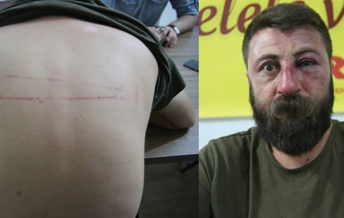 Mahkeme işkenceci polisi savundu: Hiddetli elemin etkisi altında darp yoluna başvurdu