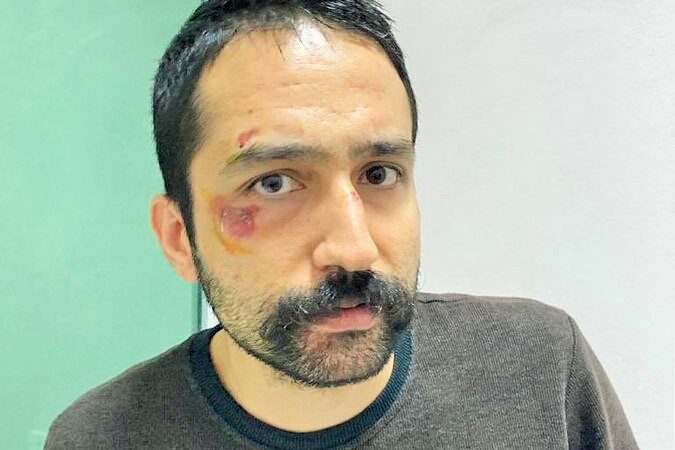 Av.Ünsal’ın babası oğluna Edirne’de yapılan işkenceye isyan etti: Yaşamak için nereye gidelim