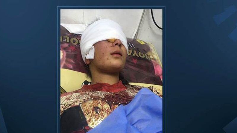 Türkiye’nin Başika üssüne roketli saldırı: Bir asker hayatını kaybetti