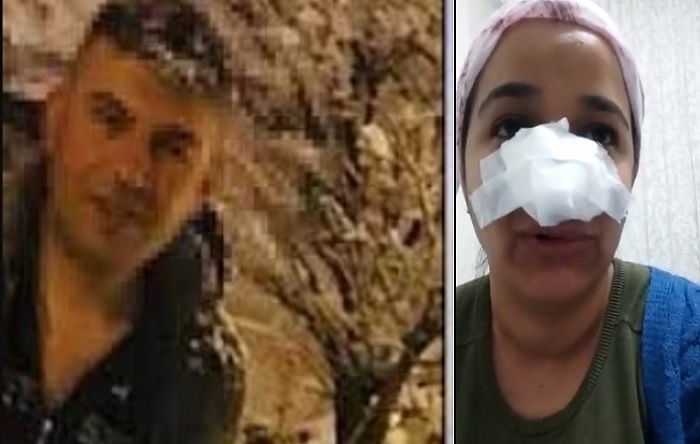 Bingöl’de uzman çavuş, bir kadını darp edip burnunu kırdı