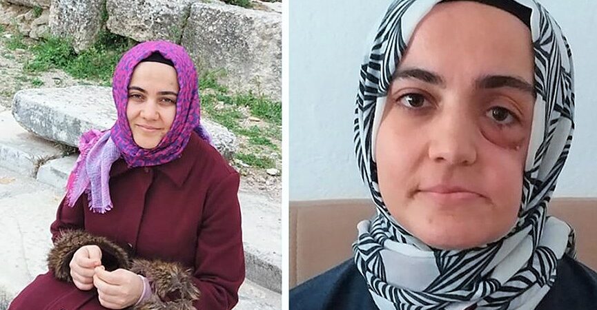 Hak İnisiyatifi’nden Erdoğan’a kanser hastası Ayşe Özdoğan çağrısı: Af yetkinizi kullanın