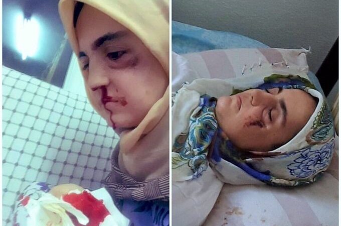 Ayşe Özdoğan raporunu inceleyen Mazlumder: Mahpusların ölümüne yol açan Adli Tıp lağvedilmeli