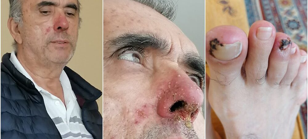 Tutuklu kanser hastası Ahmet Zeki Özcan’ın kızının feryadı: Sesime ses olun, babamı ölüme terk etmeyin
