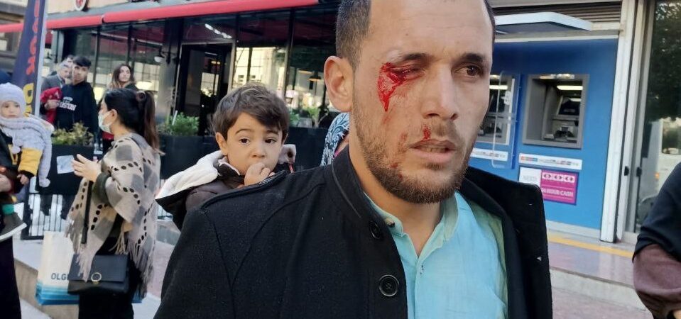 Erdoğan rejimi zulümde sınır tanımıyor: Polisin saldırması sonucu, birçok Furkan Vakfı gönüllüsü yaralandı