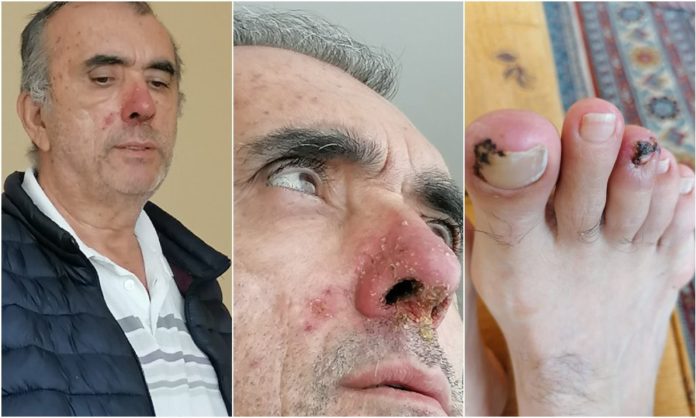 Adalet Bakanlığı nihayet duydu: Zeki Özkan’a ilaçları veriliyor, ceza tehiri işlemleri re’sen başlatıldı
