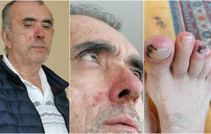 4. evre kanser hastası Ahmet Zeki Özkan tahliye edildi