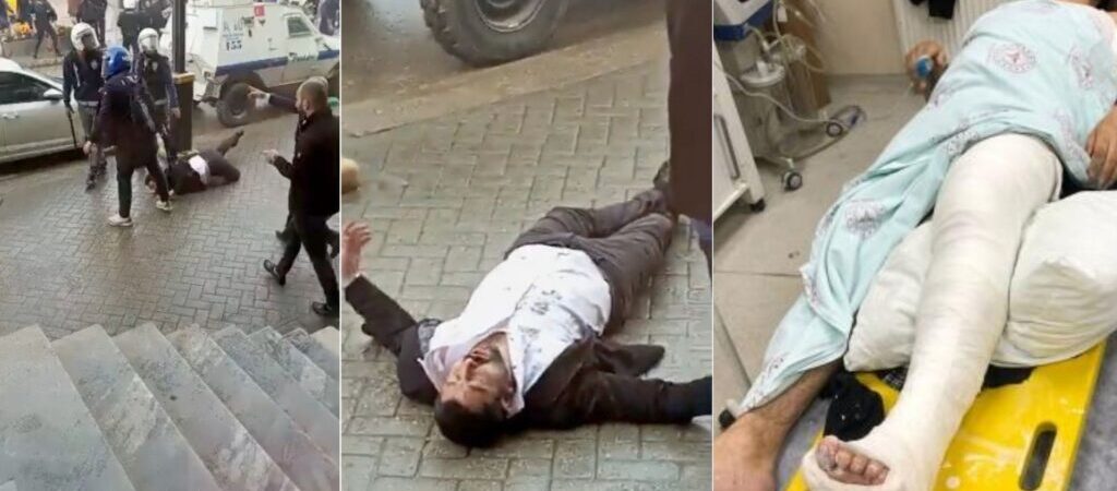 Polisin darp ettiği HDP’li Habib Eksik’in ayağı kırıldı