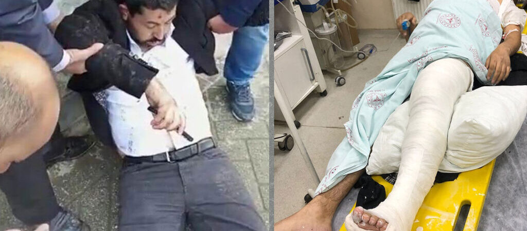 Milletvekili Habip Eksik: Polis, bilinçli olarak ayaklarımızı, bacaklarımızı kırmak için vurdular