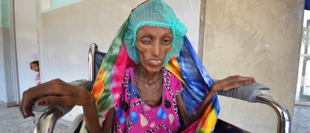 BM’den acı itiraf: Yemen halkı sessizce ölüyor