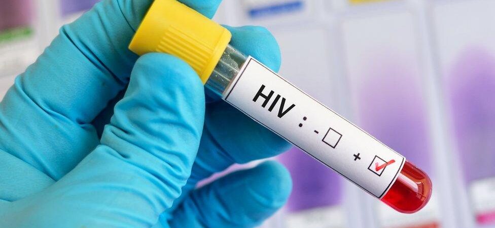 Avustralya bilim insanlarından, HIV tedavisinde tarihi adım: Virüs hücre içinde görünür hâle getirildi