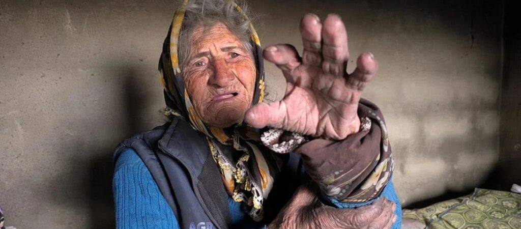 Cumhur ittifakı ortağı Bahçeli’nin memleketinde dram: 71 yaşındaki kadının yaşam mücadelesi
