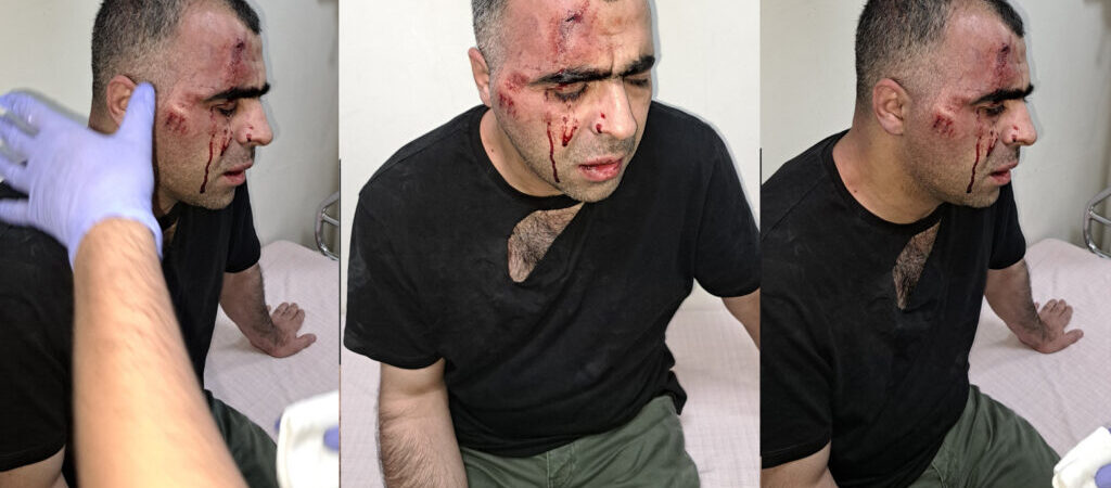 Gazeteci Sinan Aygül’e saldıran iki koruma da gözaltında