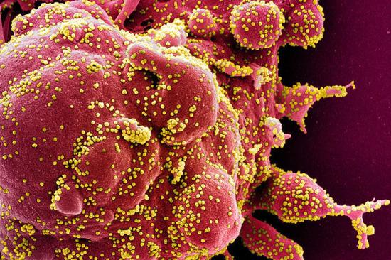 Avustralyalı Bilim insanları, yapay zeka desteğiyle 162 bin virüs türü keşfetti