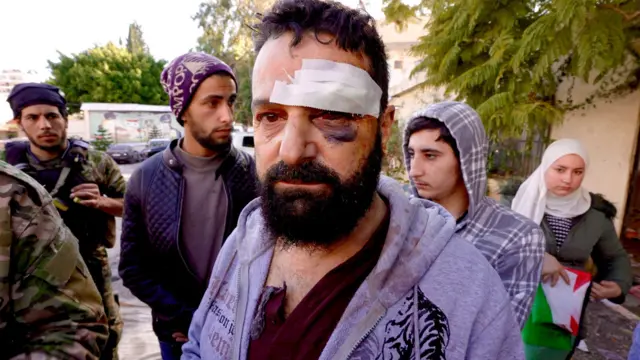 Maskeli ve silahlı katiller, Suriye’de Alevi köyüne yaptığı baskınla 10 kişiyi katletti