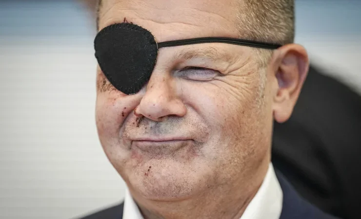 Alman Başbakan Olaf Scholz, yaralı olduğu fotoğrafı paylaştı
