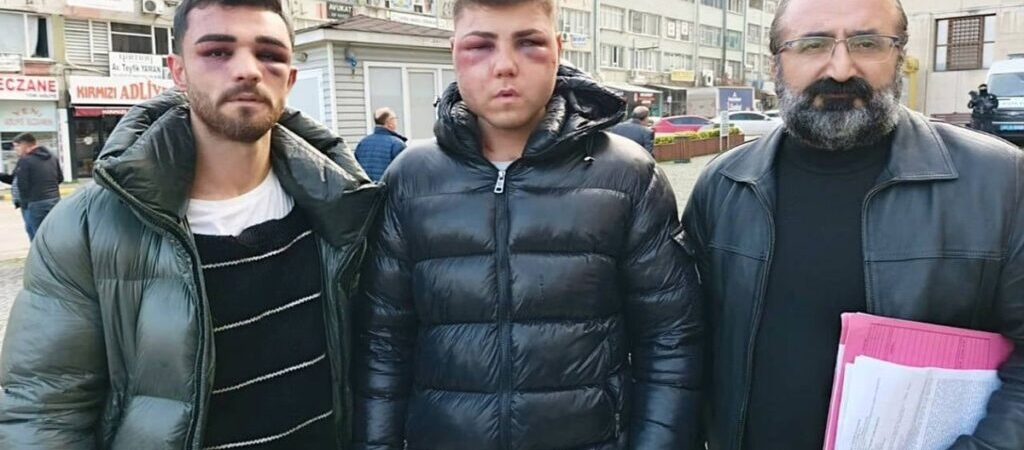 Teşhis ettiler ama hiçbir işlem yapılmadı: Polis işkencesine dava yok