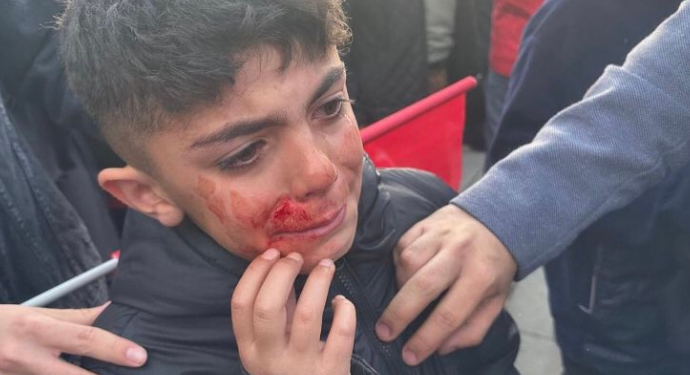 Erdoğan ve Cumhur ittifakı’nın eşkıyaları, Erzurum’daki saldırıda çocukları da yaraladılar