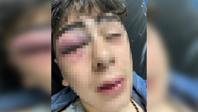 Diyarbakır Lice’de 14 yaşındaki çocuğa işkence eden 3 polise gözaltı