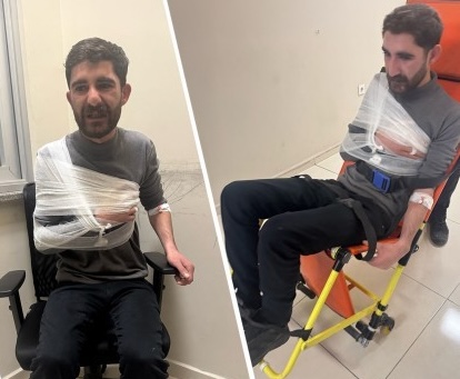 Van’daki kayyım gaspını protesto edenlere polis işkencesi: Omzu çıktı, parmakları kırıldı