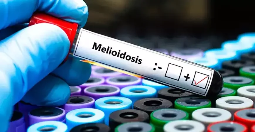 Queensland’de melioidoz hastalığı nedeniyle 31 kisi hayatını kaybetti