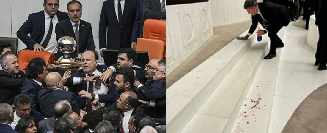 AKP’liler Meclis’te terör estirdi: DEM Partili Koçyiğit, aldığı darbeyle kaşı yarıldı